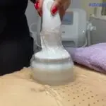 Ultrassom microfocado aplicação abdominal