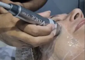 Aplicação VISAGE facial