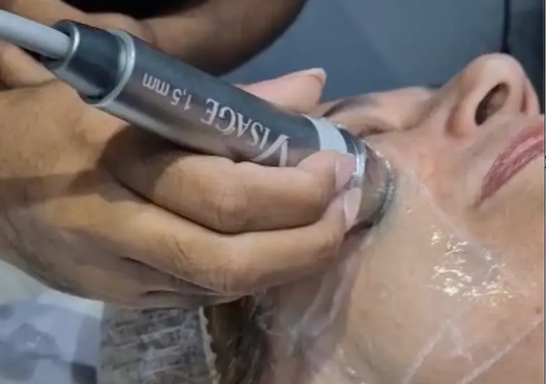 Aplicação VISAGE facial